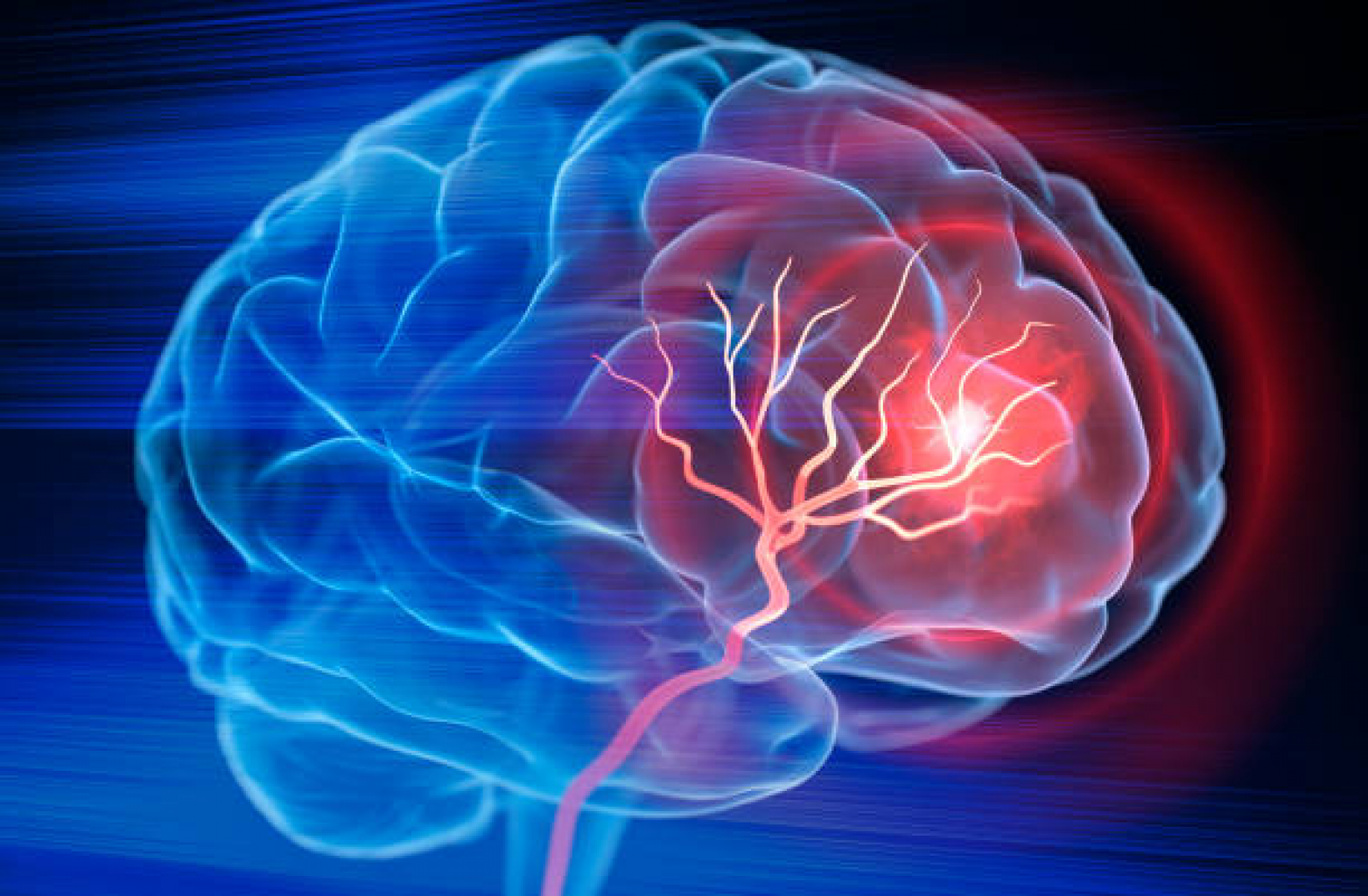 Mes de Concientización de la salud del cerebro-columna vertebral y el Sistema nervioso