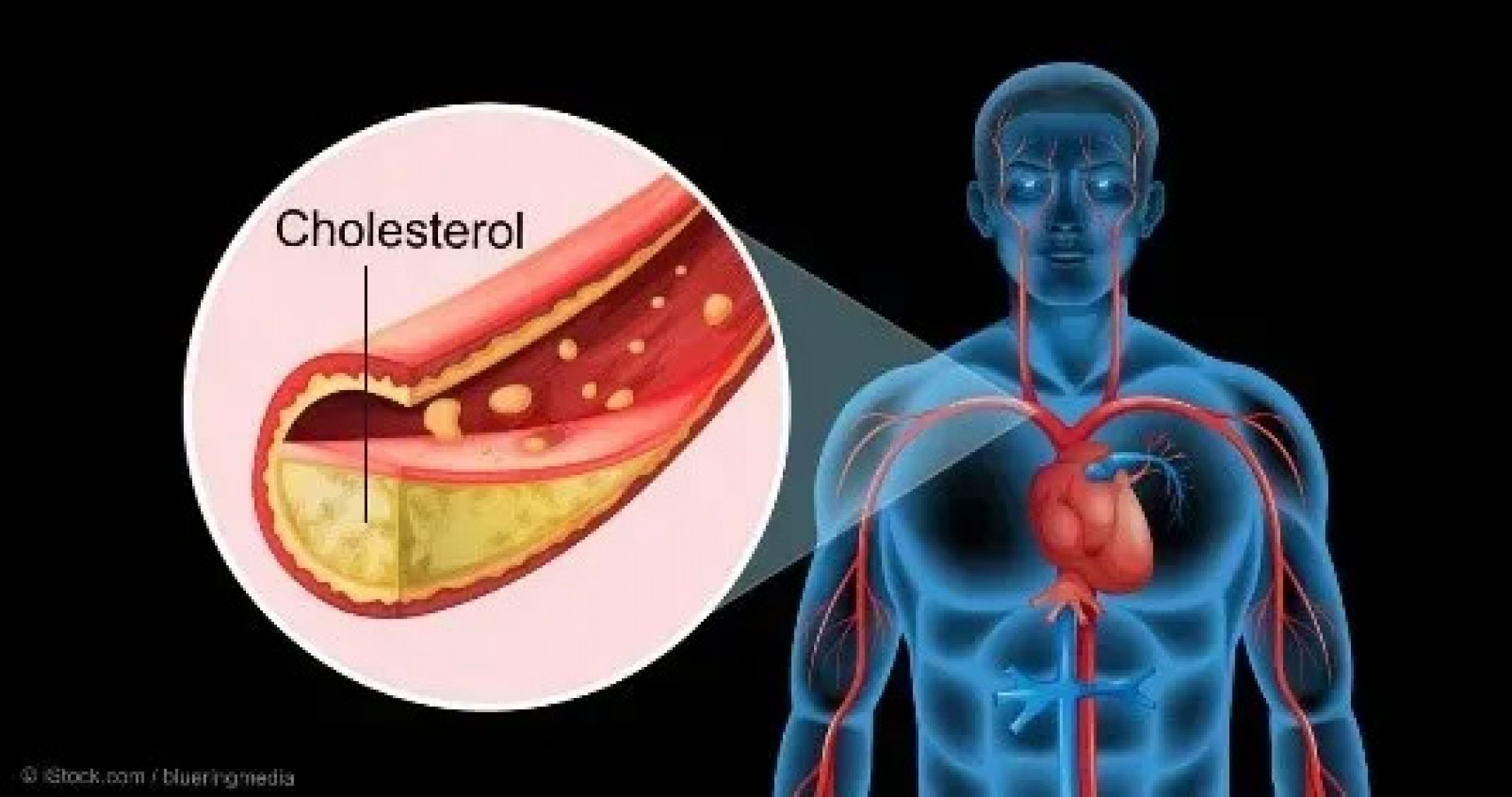 Cómo entender el colesterol: lo que necesita saber para un corazón saludable