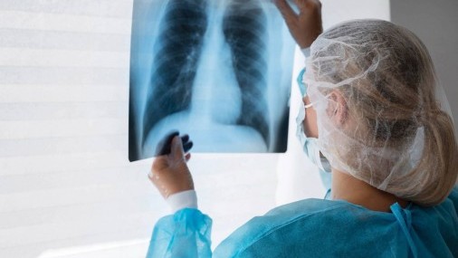 Oklahoma lanza HOPE para combatir el cáncer de pulmón